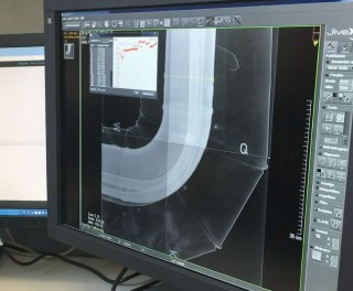 Digital “stitching” of X-ray films ..